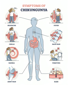 Chikungunya Virus Infection: Symptoms and NIH Public Safety Guidelines