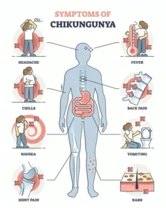 Chikungunya Virus Infection: Symptoms and NIH Public Safety Guidelines