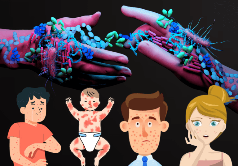Pimples To Rashes: 10 Signs That Your Hands Could Be Spreading Germs