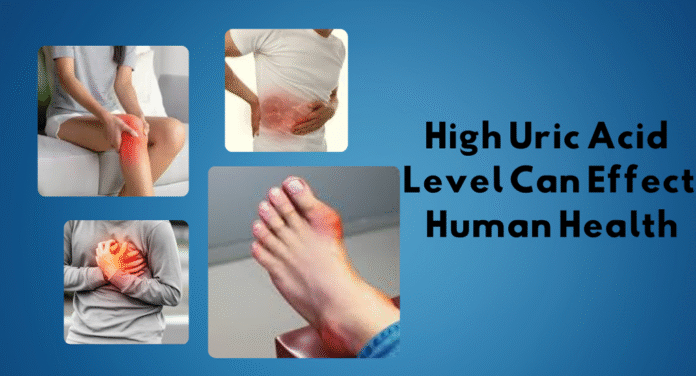 A collage of individuals experiencing pain in the knee, abdomen, chest, and foot, highlighting the effects of high uric acid levels on health.